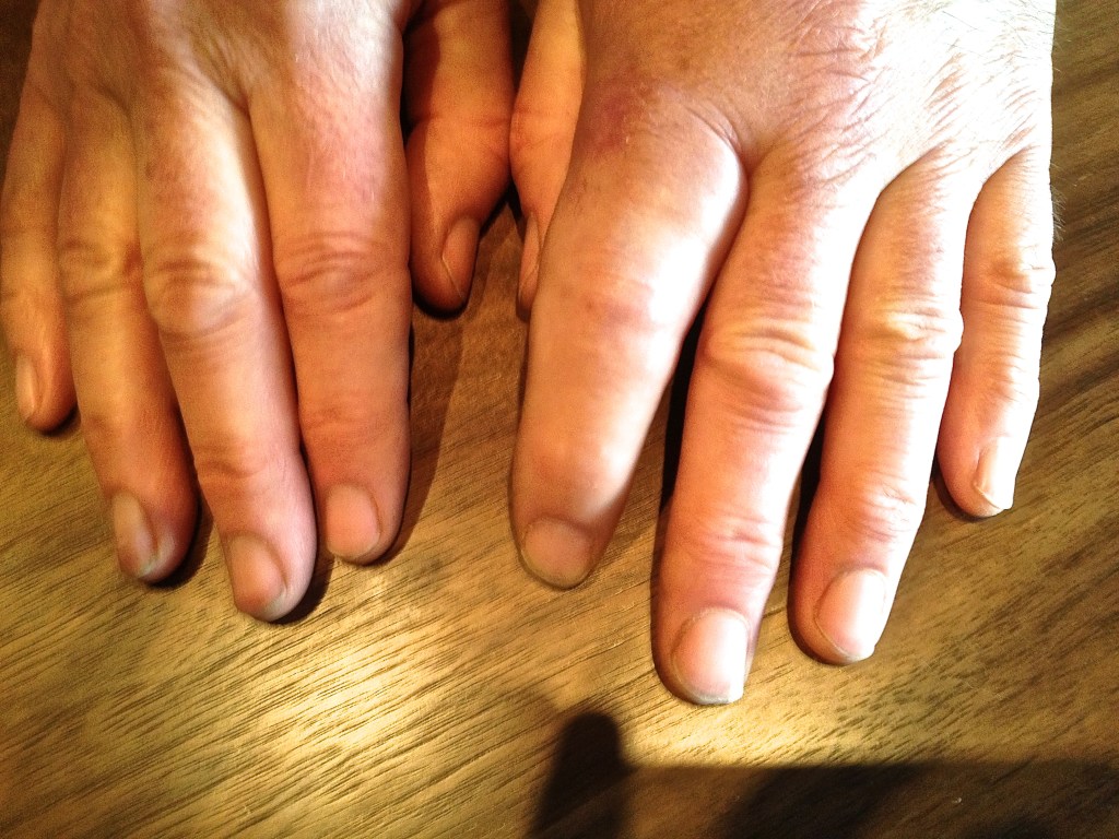 comparing both hands